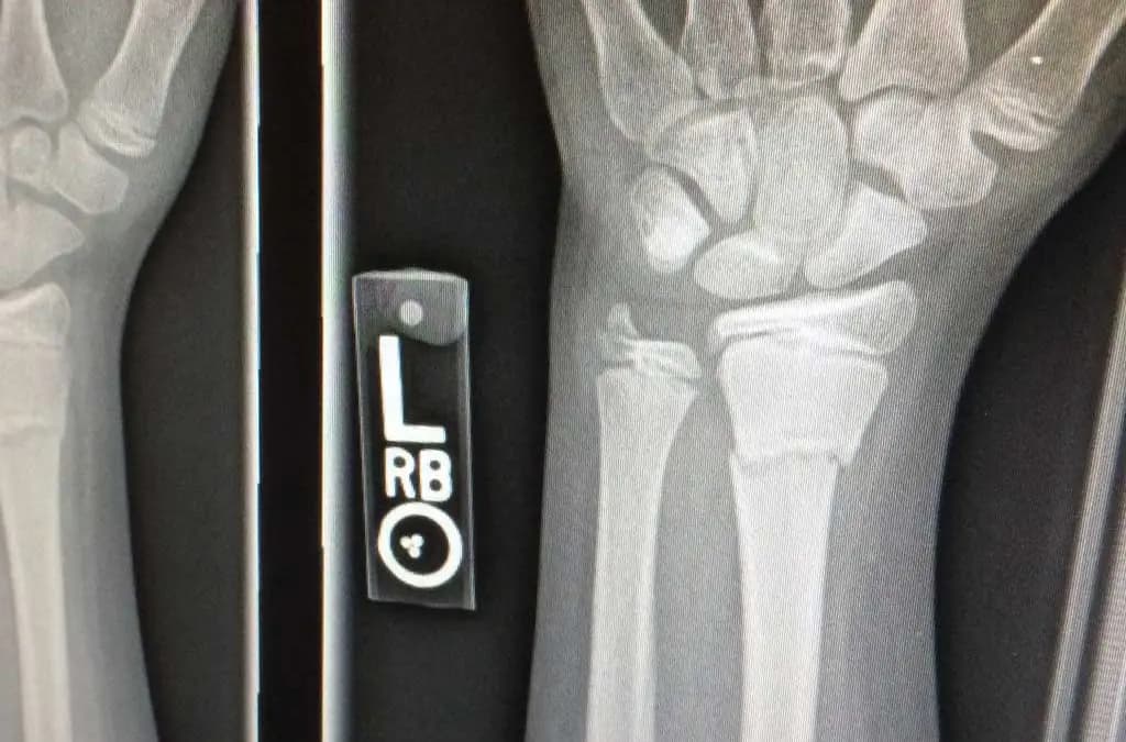 Breaking Down of the Injuries Board: How the Board Works